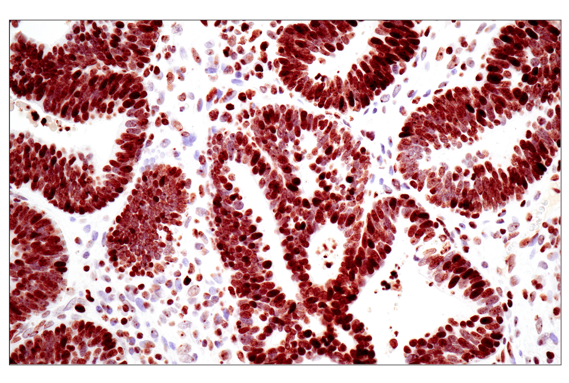 Immunohistochemistry Image 1: Tri-Methyl-Histone H3 (Lys27) (C36B11) Rabbit mAb