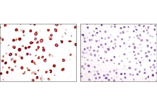 undefined Image 10: PhosphoPlus<sup>®</sup> Btk (Tyr223) Antibody Duet