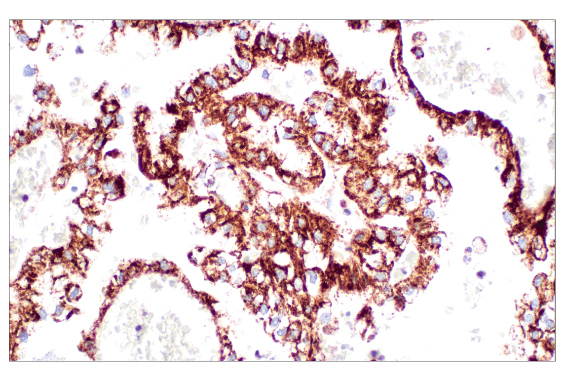undefined Image 28: Cell Fractionation Antibody Sampler Kit