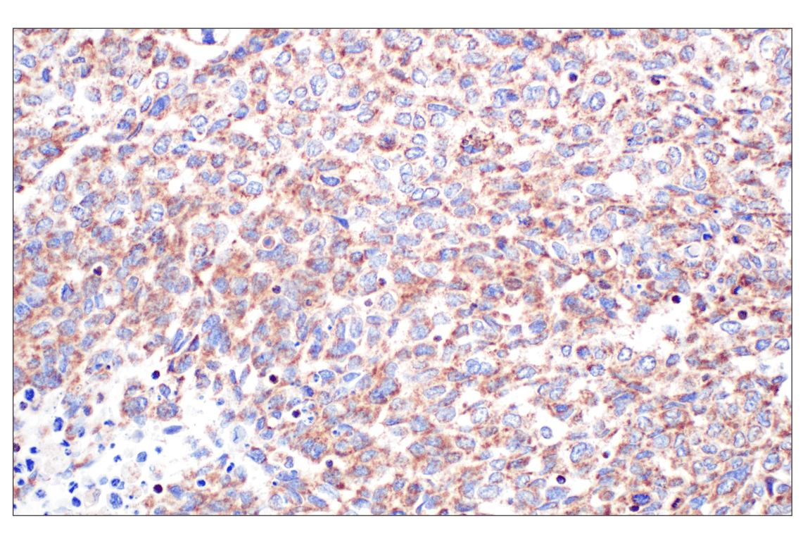 Immunohistochemistry Image 2: GCDH (F2P2M) Rabbit mAb