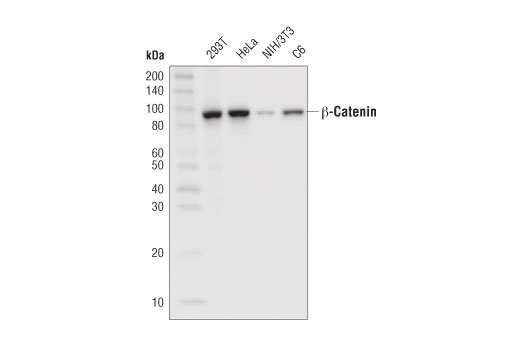 Western Blotting Image 1: β-Catenin (D10A8) XP<sup>®</sup> Rabbit mAb (HRP Conjugate)