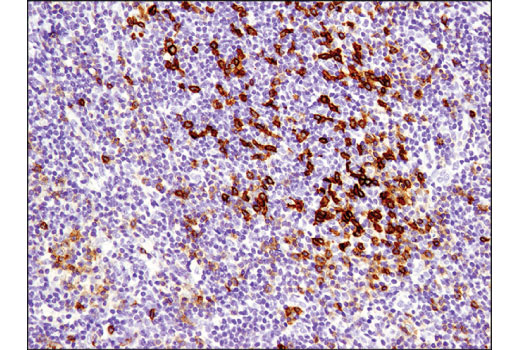 Immunohistochemistry Image 2: PD-1 (Intracellular Domain) (D4W2J) XP<sup>®</sup> Rabbit mAb