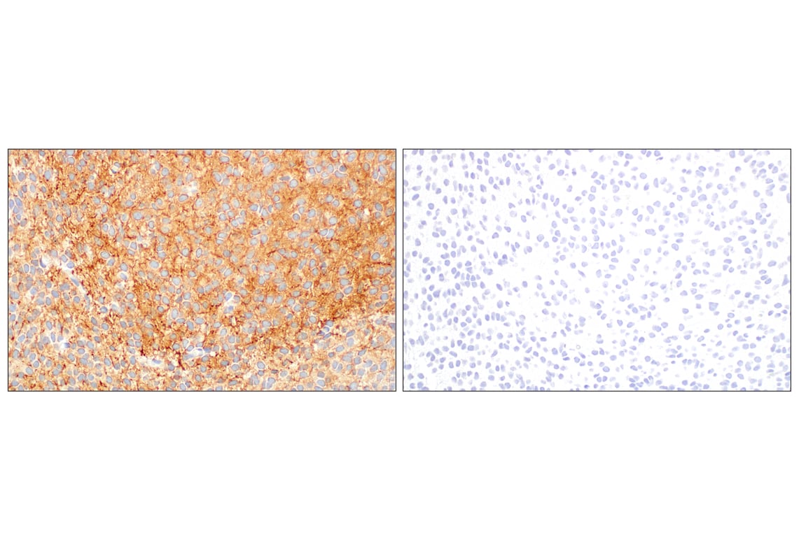 Immunohistochemistry Image 6: Doublecortin (E3S7L) Rabbit mAb (BSA and Azide Free)