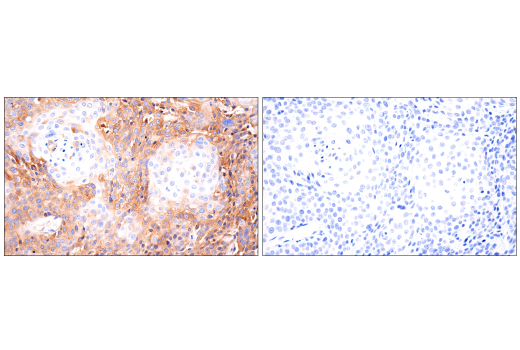 Immunohistochemistry Image 5: CD109 (E4I2V) Rabbit mAb