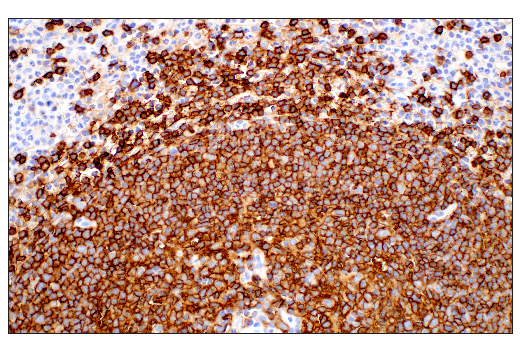 Immunohistochemistry Image 7: CD20 (L26) Mouse mAb