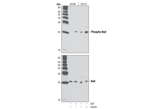 Western Blotting Image 1: Phospho-Bad (Ser136) (D25H8) Rabbit mAb