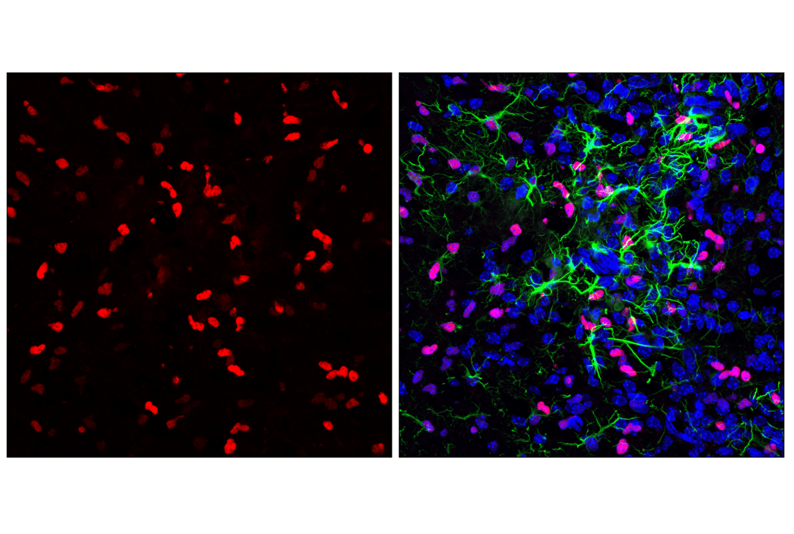 Immunofluorescence Image 1: Olig2 (E6G6Q) XP<sup>®</sup> Rabbit mAb (Alexa Fluor<sup>®</sup> 555 Conjugate)