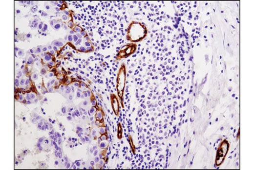 Immunohistochemistry Image 1: Integrin β3 (D7X3P) XP<sup>®</sup> Rabbit mAb