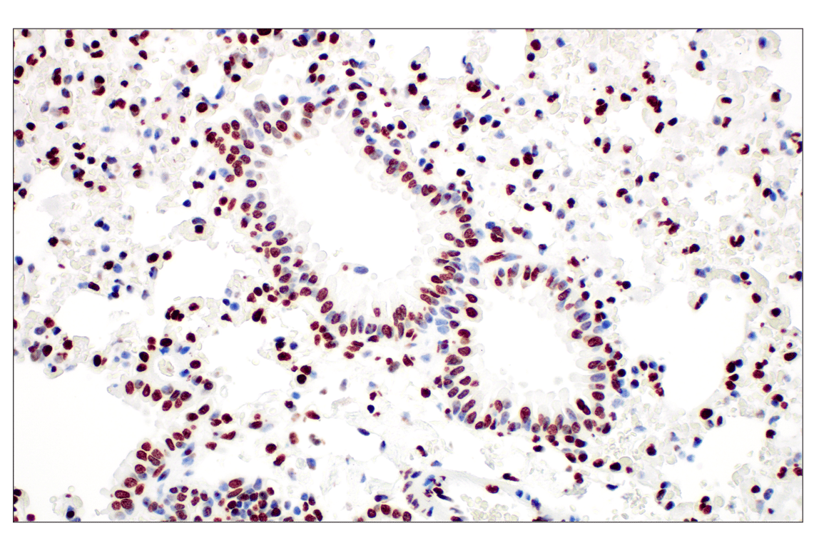 Immunohistochemistry Image 3: Tri-Methyl-Histone H3 (Lys27) (C36B11) Rabbit mAb