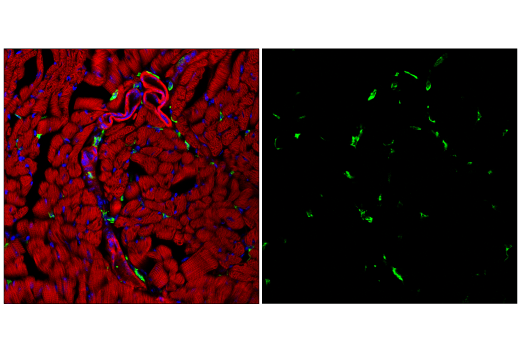 Immunofluorescence Image 3: CD206/MRC1 (E6T5J) XP<sup>®</sup> Rabbit mAb (BSA and Azide Free)