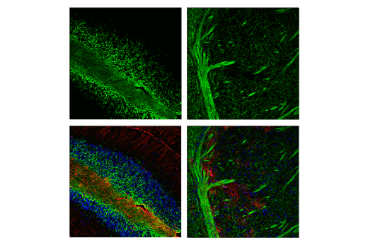 undefined Image 11: Demyelinating Disease Targets Antibody Sampler Kit