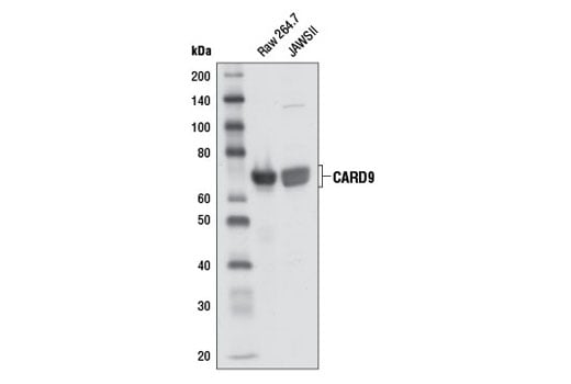 Western Blotting Image 1: CARD9 Antibody