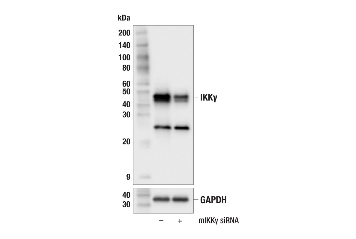 Western Blotting Image 2: IKKγ (F8I8M) Rabbit mAb