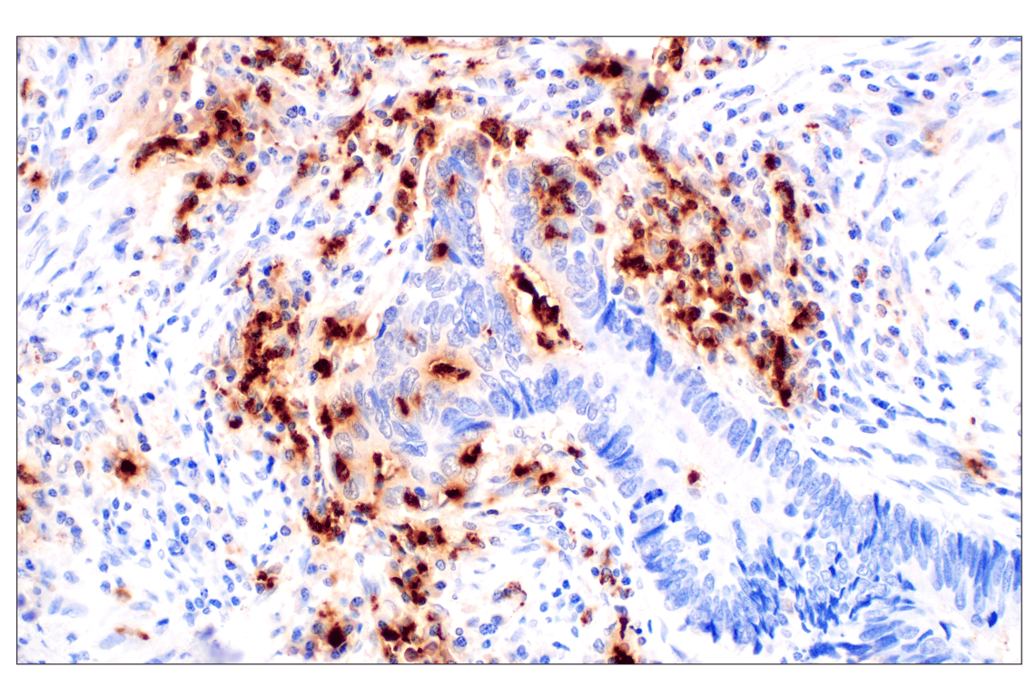 Immunohistochemistry Image 1: Neutrophil Elastase (F4H3X) Rabbit mAb (BSA and Azide Free)