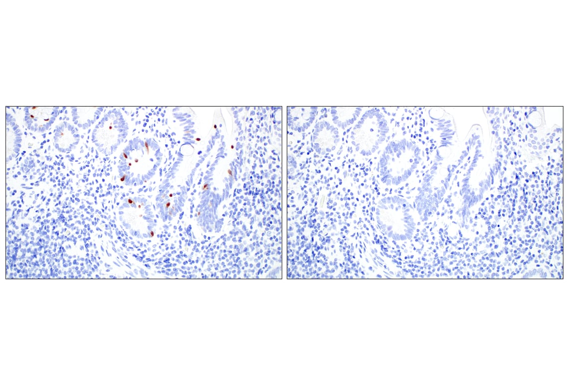 Immunohistochemistry Image 5: OCA-T1 (E4T1K) Rabbit mAb (BSA and Azide Free)