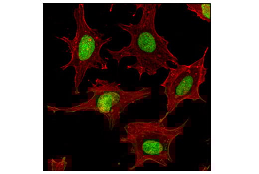 Immunofluorescence Image 1: Mono-Methyl-Histone H3 (Lys36) (D9J1D) Rabbit mAb