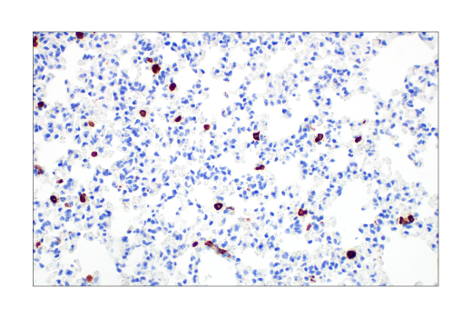 Immunohistochemistry Image 2: CD206/MRC1 (E6T5J) XP<sup>®</sup> Rabbit mAb (BSA and Azide Free)