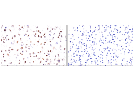 Immunohistochemistry Image 10: HIF-1α (E1V6A) Rabbit mAb