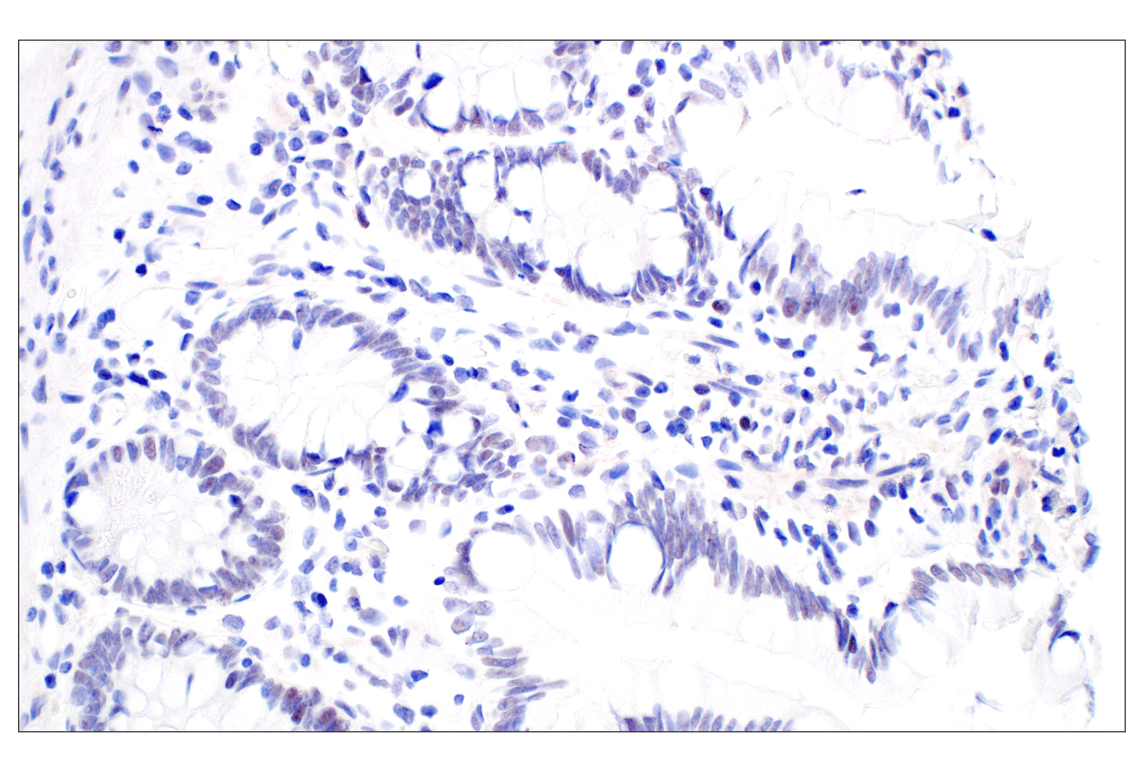 Immunohistochemistry Image 7: MDM2 (F7W7X) Rabbit mAb