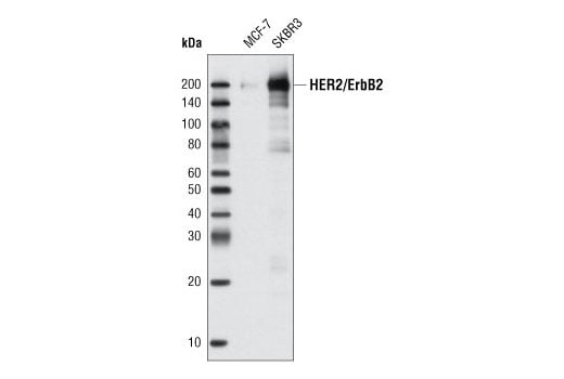 Western Blotting Image 1: HER2/ErbB2 Antibody