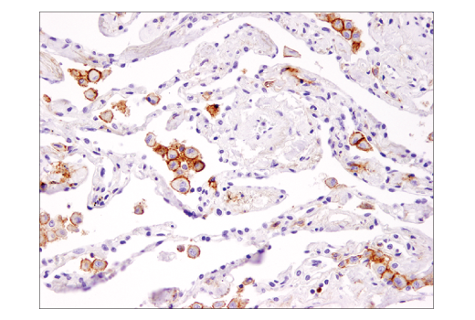 Immunohistochemistry Image 1: TIM-3 (D5D5R<sup>™</sup>) XP<sup>®</sup> Rabbit mAb (BSA and Azide Free)