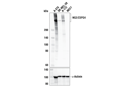 Western Blotting Image 3: NG2/CSPG4 (E3B3G) XP<sup>®</sup> Rabbit mAb (BSA and Azide Free)