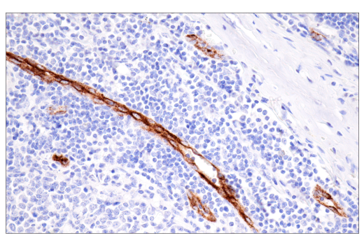 Immunohistochemistry Image 4: CD62P/P-Selectin (E8Q1W) XP<sup>®</sup> Rabbit mAb (BSA and Azide Free)