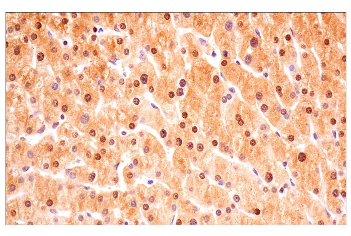 Immunohistochemistry Image 11: ACBP/DBI (E6K8G) XP<sup>®</sup> Rabbit mAb