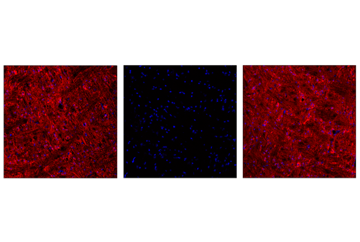 Immunofluorescence Image 1: Phospho-Tau (Thr205) (E7D3E) Rabbit mAb (Alexa Fluor<sup>®</sup> 647 Conjugate)