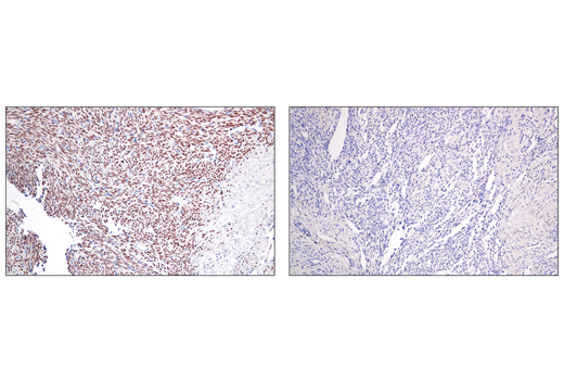 Immunohistochemistry Image 1: SS18-SSX (E9X9V) XP<sup>®</sup> Rabbit mAb (BSA and Azide Free)