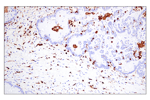 Immunohistochemistry Image 7: Iba1/AIF-1 (E4O4W) XP<sup>®</sup> Rabbit mAb (BSA and Azide Free)