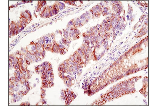 Immunohistochemistry Image 1: NDRG1 (D8G9) XP<sup>®</sup> Rabbit mAb