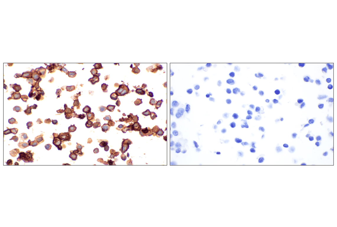 Immunohistochemistry Image 7: MAdCAM-1 (E1V8F) Rabbit mAb