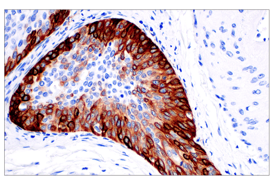 Immunohistochemistry Image 2: Keratin 14 (E7W6V) Rabbit mAb