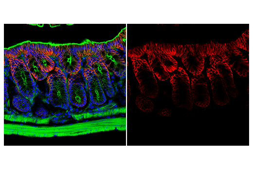 Immunofluorescence Image 2: AQP4 (D1F8E) XP<sup>®</sup> Rabbit mAb (Alexa Fluor<sup>®</sup> 647 Conjugate)