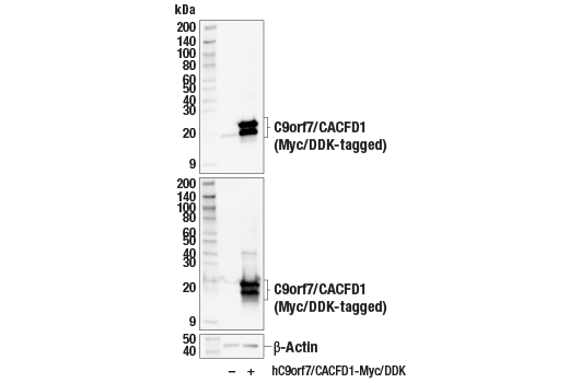 Western Blotting Image 2: C9orf7/CACFD1 (E6E3J) Rabbit mAb