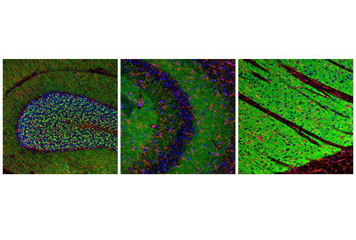 Immunofluorescence Image 1: SHANK3 (D5K6R) Rabbit mAb (BSA and Azide Free)