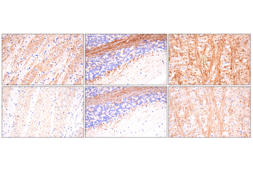 Immunohistochemistry Image 5: Neurofilament-H (E7Z7G) Rabbit mAb