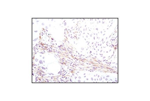 Immunohistochemistry Image 4: PDGF Receptor α (D1E1E) XP<sup>®</sup> Rabbit mAb