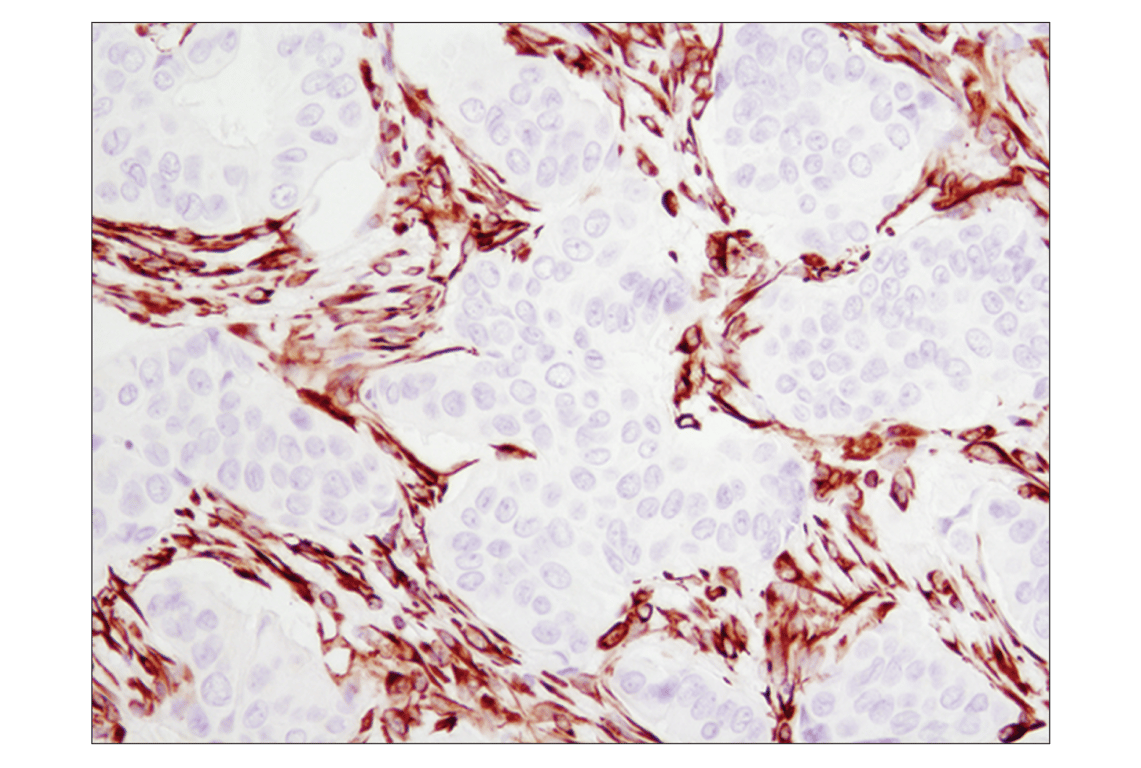 Immunohistochemistry Image 1: Vimentin (D21H3) XP<sup>®</sup> Rabbit mAb (BSA and Azide Free)