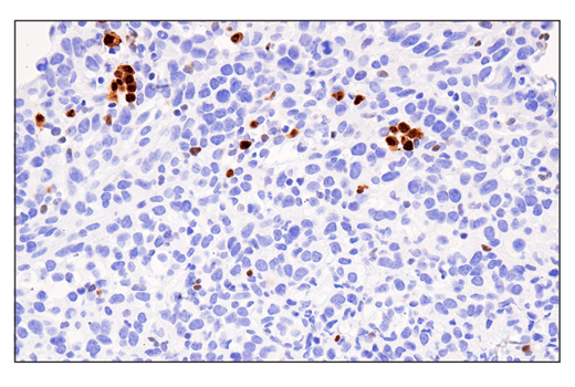 Immunohistochemistry Image 1: IRF-4 (E8H3S) XP<sup>®</sup> Rabbit mAb (BSA and Azide Free)