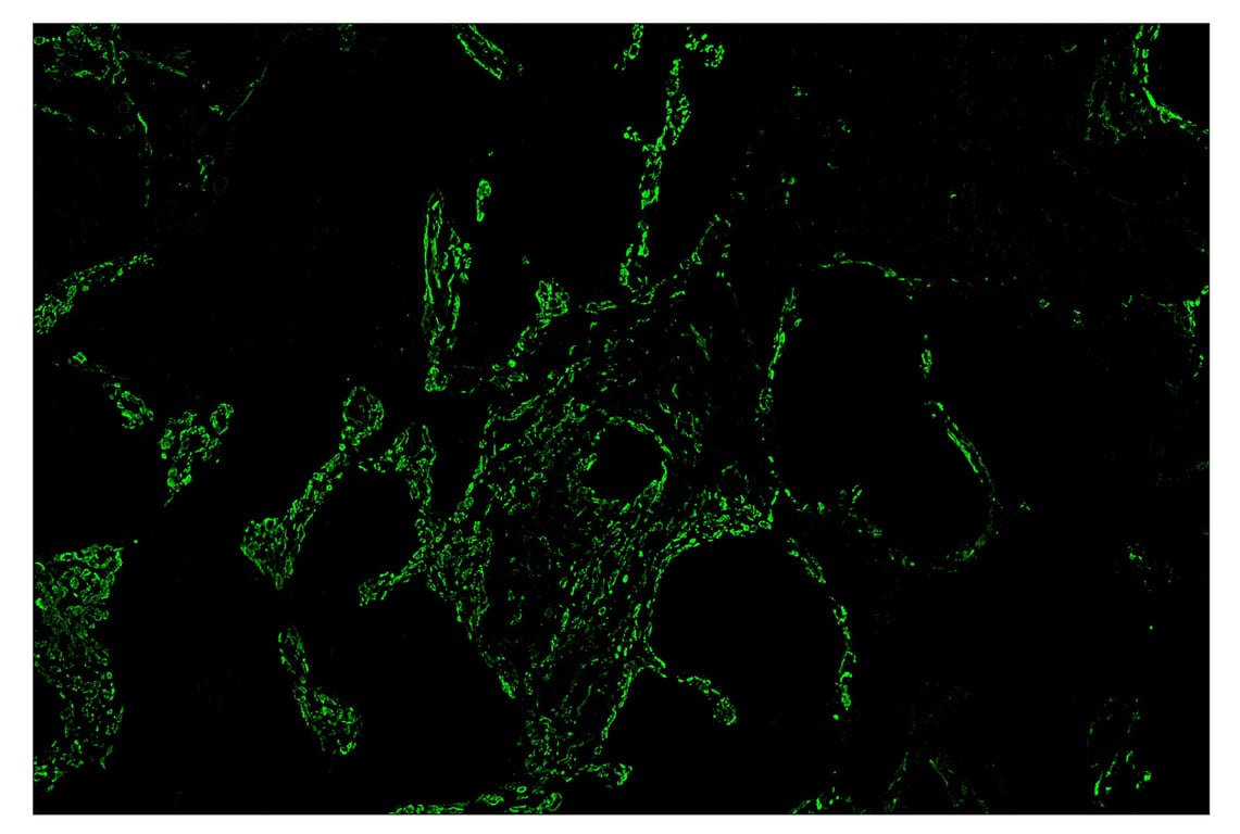 Immunohistochemistry Image 2: α-Smooth Muscle Actin (D4K9N) & CO-0024-488 SignalStar<sup>™</sup> Oligo-Antibody Pair