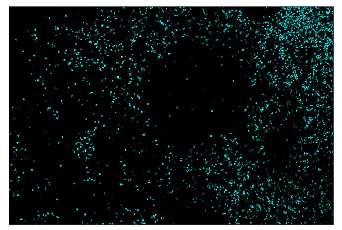 Immunohistochemistry Image 5: TCF1/TCF7 (C63D9) & CO-0006-594 SignalStar<sup>™</sup> Oligo-Antibody Pair