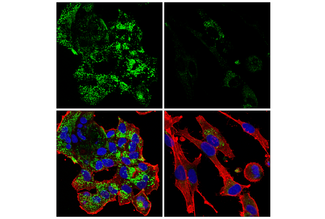 Immunofluorescence Image 1: Cathepsin D (E5V4H) Rabbit mAb