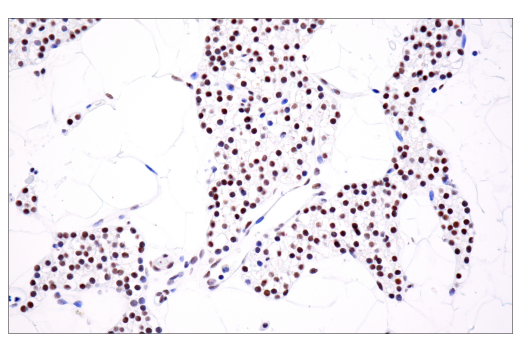 Immunohistochemistry Image 6: ATRX (E5X7O) Rabbit mAb (BSA and Azide Free)