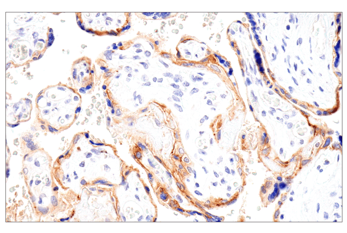 Immunohistochemistry Image 5: Folate Receptor Alpha/FOLR1 (BN3.2) Mouse mAb