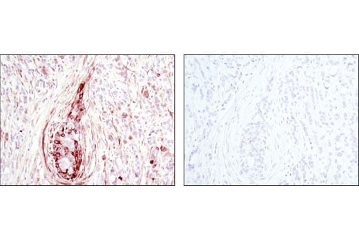 Immunohistochemistry Image 1: Phospho-HSP27 (Ser82) (D1H2F6) XP<sup>®</sup> Rabbit mAb (BSA and Azide Free)