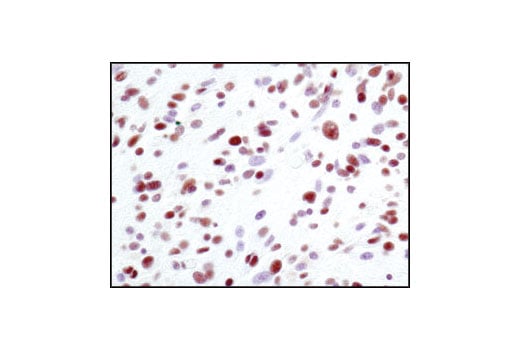 undefined Image 11: Non-Homologous End Joining (NHEJ) DNA Repair Antibody Sampler Kit