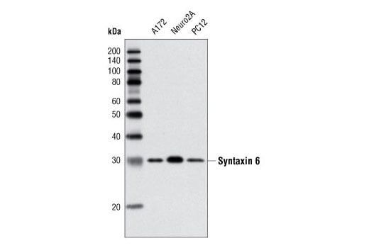 Western Blotting Image 1: Syntaxin 6 (C34B2) Rabbit mAb
