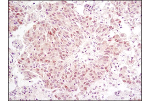 Immunohistochemistry Image 2: RSK2 (D21B2) XP<sup>®</sup> Rabbit mAb (BSA and Azide Free)